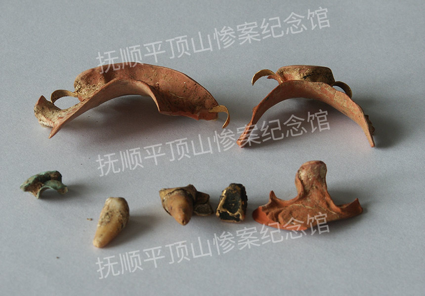 总183-1932年平顶山惨案遇难者的金牙套.jpg
